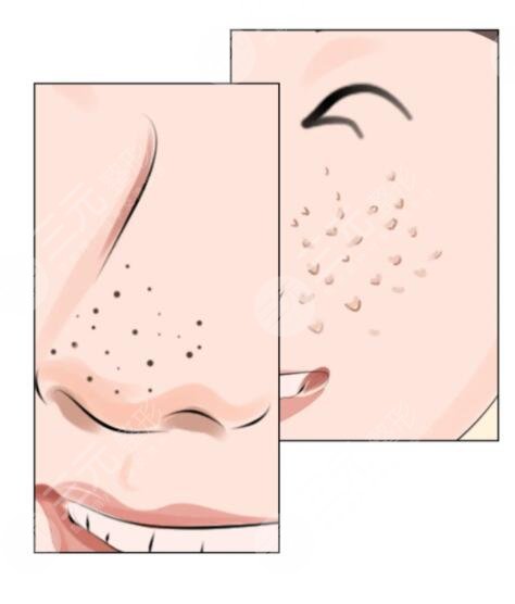 皮肤毛孔大怎么办?