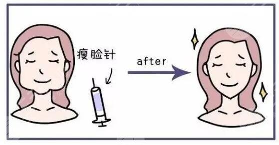 咬肌大怎么办怎么改良快速又有？怎么判断自己咬肌是否过大？