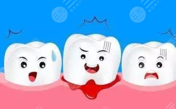 牙缝出血