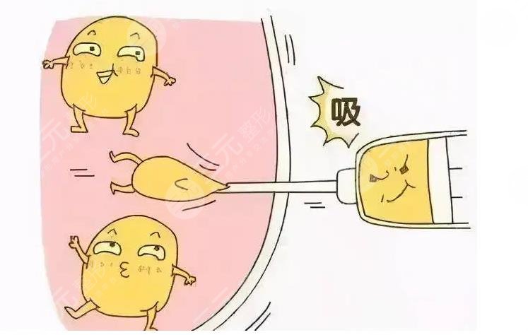 陕西高一生整形怎么样?