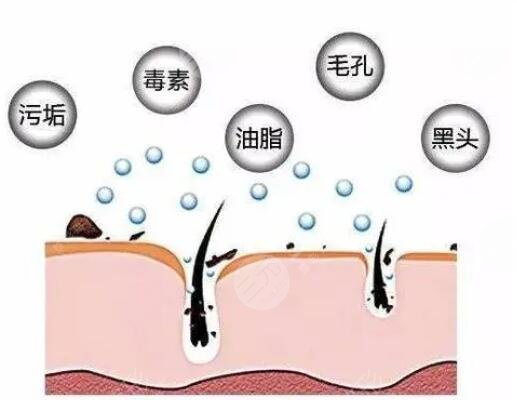怎么收缩面部毛孔有又快速?