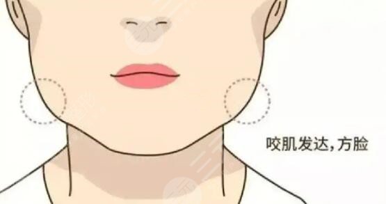 咬肌怎么变小快速的方法不动刀！照搬文中的方法可以让你更快的变小脸~