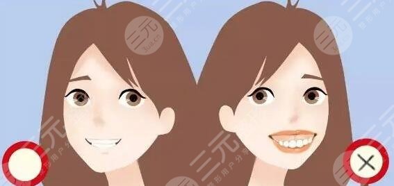 东莞人民医院正畸价格