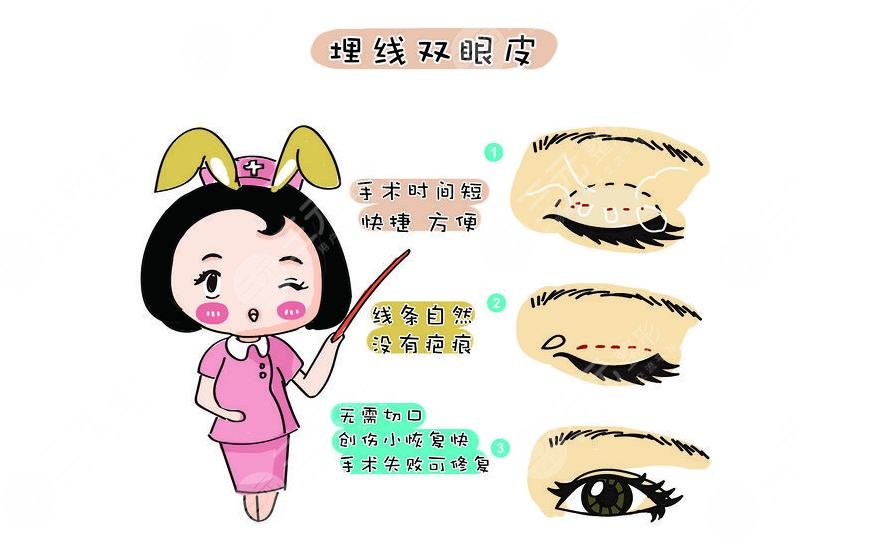双眼皮有几种做法?