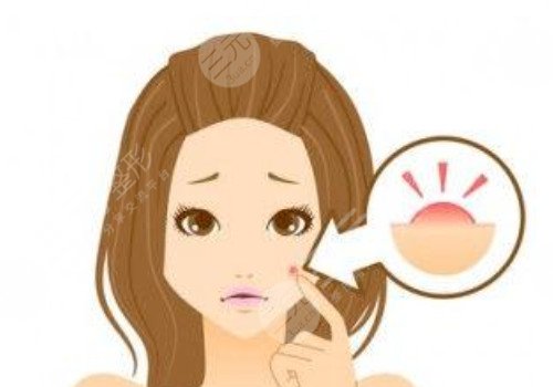 脸上痘坑可以修复吗?