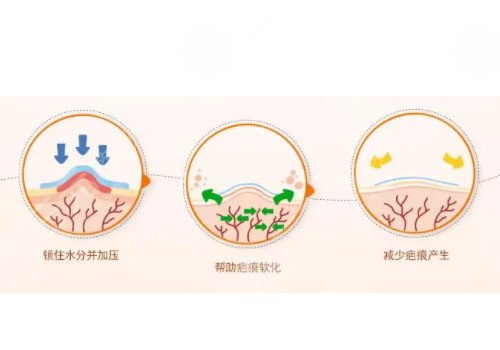 如何祛除脸上的疤痕?