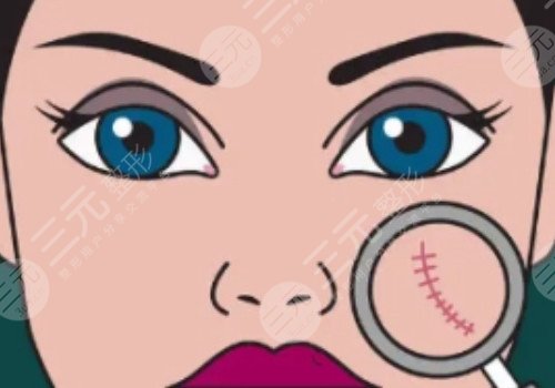 如何祛除脸上的疤痕?