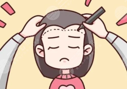 发际线高怎么挽救?