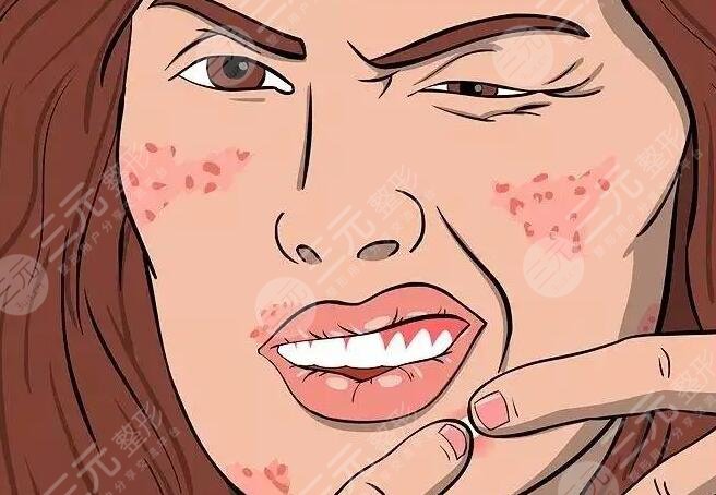 怎样消除红肿的痘痘更有？这几种方法好用又操作简单！果是肉眼可见的！