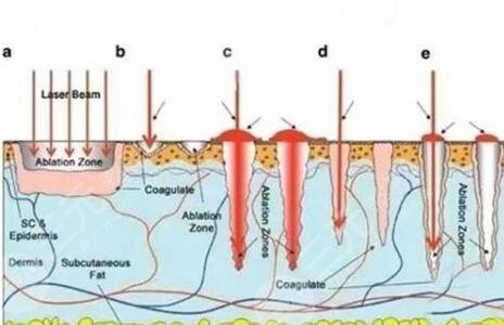 医美消除红肿的痘痘