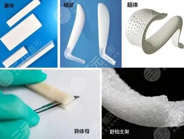 做个鼻梁需要多少钱费用？