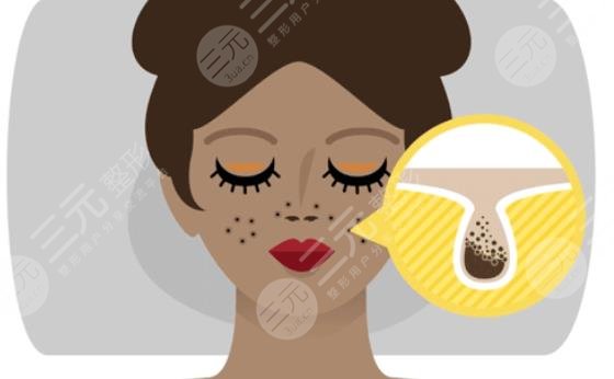 去黑头收缩毛孔