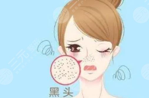 去黑头收缩毛孔