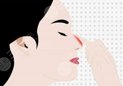 重庆华美做鼻子怎么样?