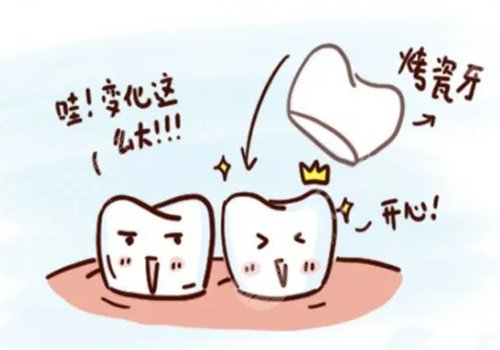 全瓷烤瓷牙的价格贵不贵?