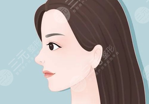 鼻头鼻翼缩小影响因素介绍