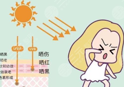 晒伤了怎么快速修复?