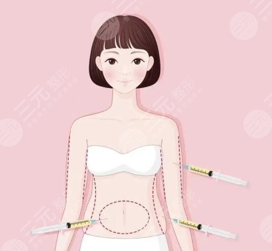 五度吸脂术的原理是怎样的？果可以维持多久？技术优势一一列出你心动吗？