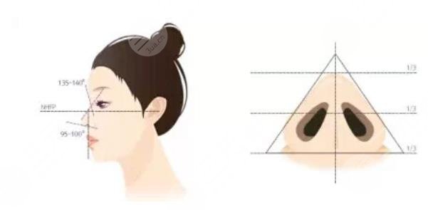 鼻翼缩小