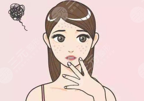 脸上的色斑怎么去掉?