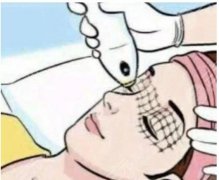 电波拉皮手术费用是多少？果好吗？术后注意事项分享！