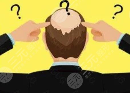 生姜擦头皮生发