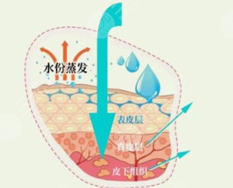 果酸