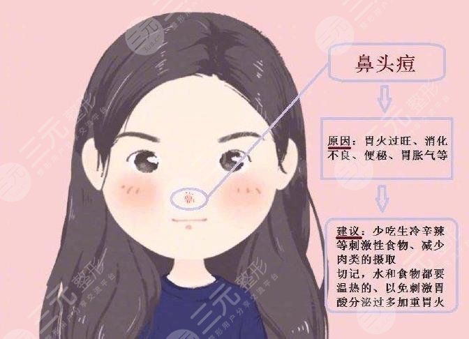 鼻子上长痘痘是什么原因引起的?