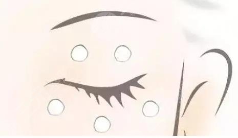 眼睛周围长脂肪粒怎么办?