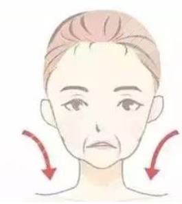 注射除皱