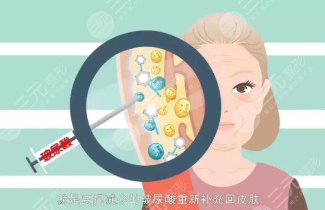 玻尿酸的用途