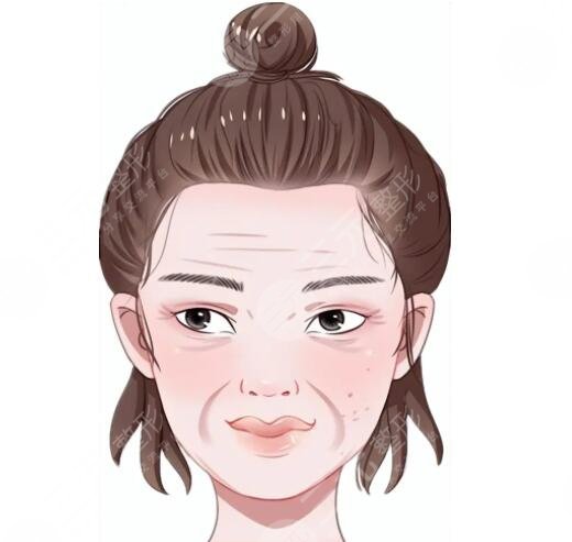 热玛吉抗衰老可能存在的副作用有哪些?果能维持多久?注意事项要做好!