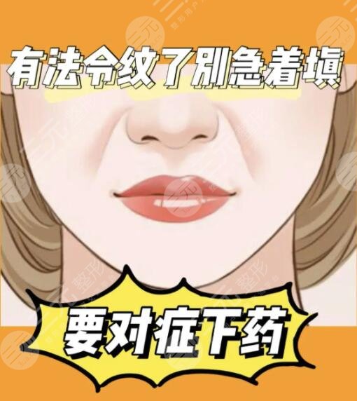 法令纹手术价钱一般多少钱?