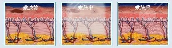 选择医美方式