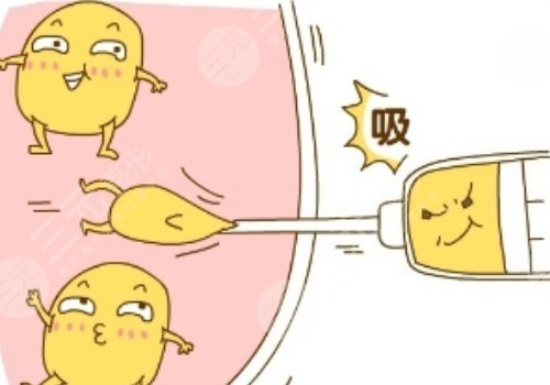 影响胳膊吸脂价格的因素?: