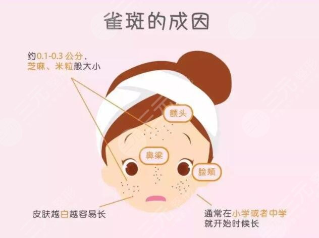 雀斑形成的原因是什么?
