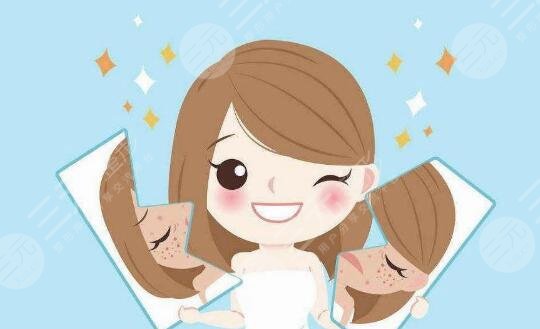 美容激光祛斑的注意事项