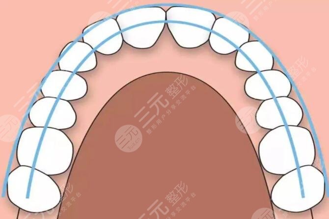 矫正牙齿的原理分析
