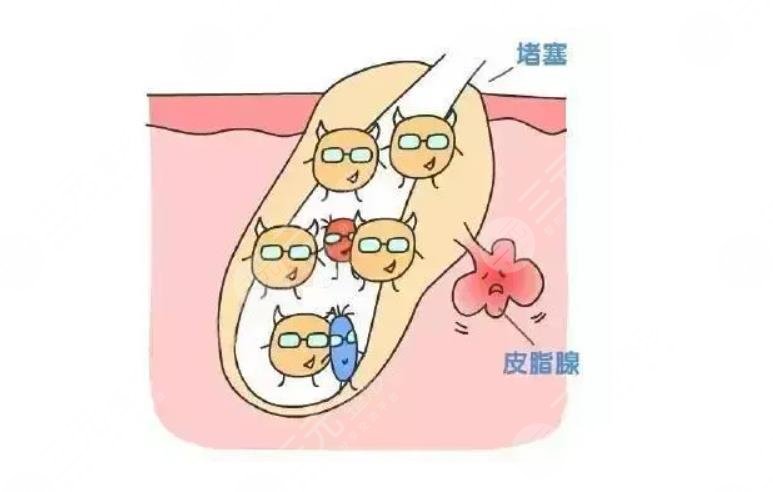 可以用?肥皂洗脸吗?