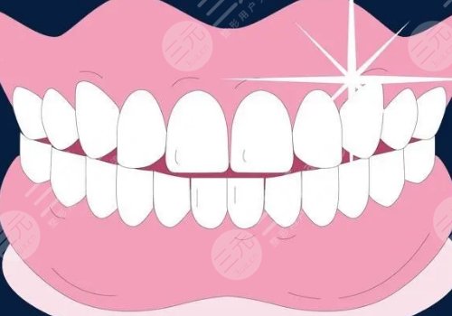 冷光美白牙齿多少钱?