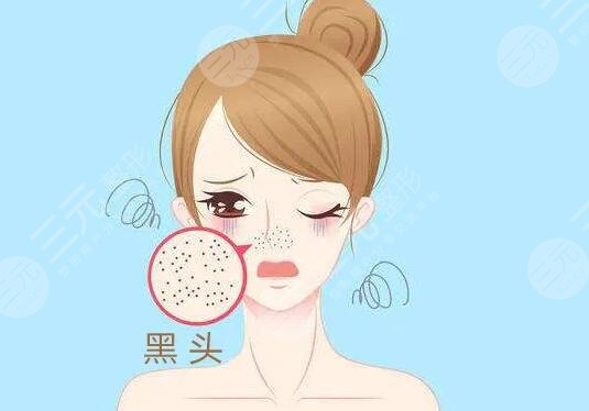 苏打水去黑头对皮肤有损害吗?