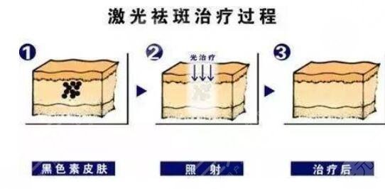 维生素C