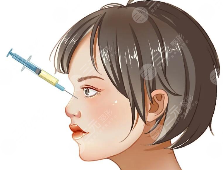 做玻尿酸隆鼻费用大概多少钱?玻尿酸隆鼻实际过程详情记录!给你一个参考对象~