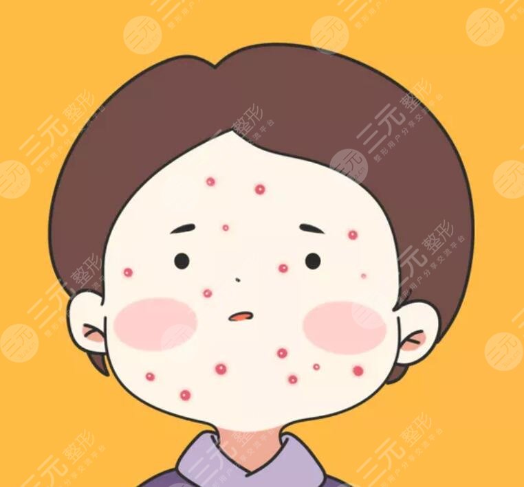 相宜本草祛痘凝胶的案例介绍