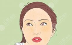 中医去黄褐斑有用吗？斑点是怎么形成的？如何去除