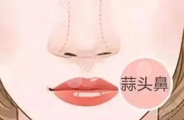 鼻头整形