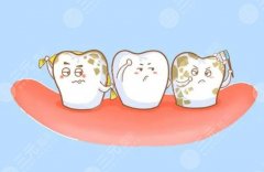 牙齿激光美白有用吗？激光牙齿美白需要做几次？术前准备工作有哪些？