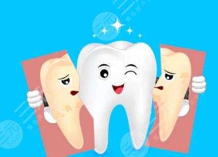 牙齿美白