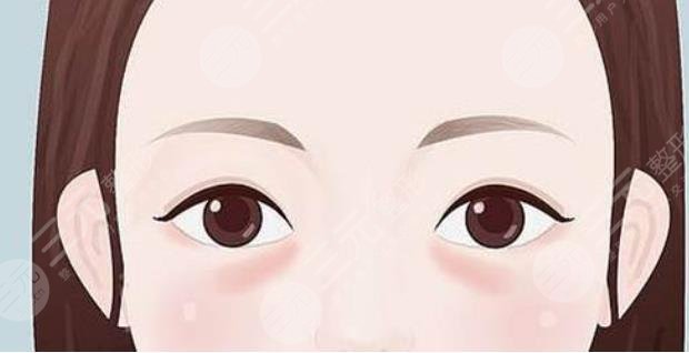 眼袋