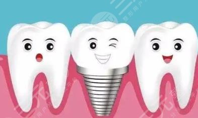 牙齿种植